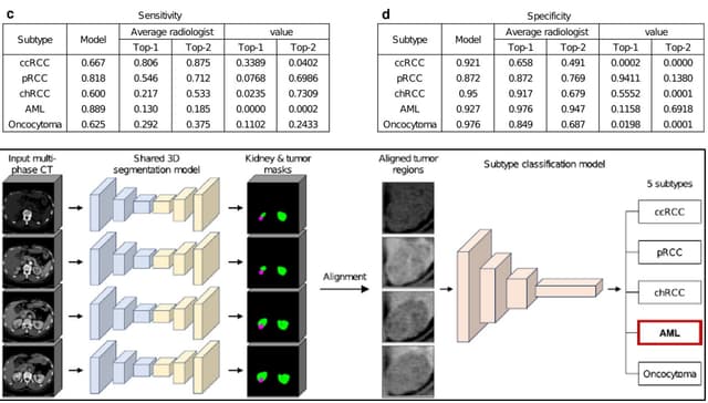 의료 분야 세계 TOP 저널 
 네이처 종양학회지 게재